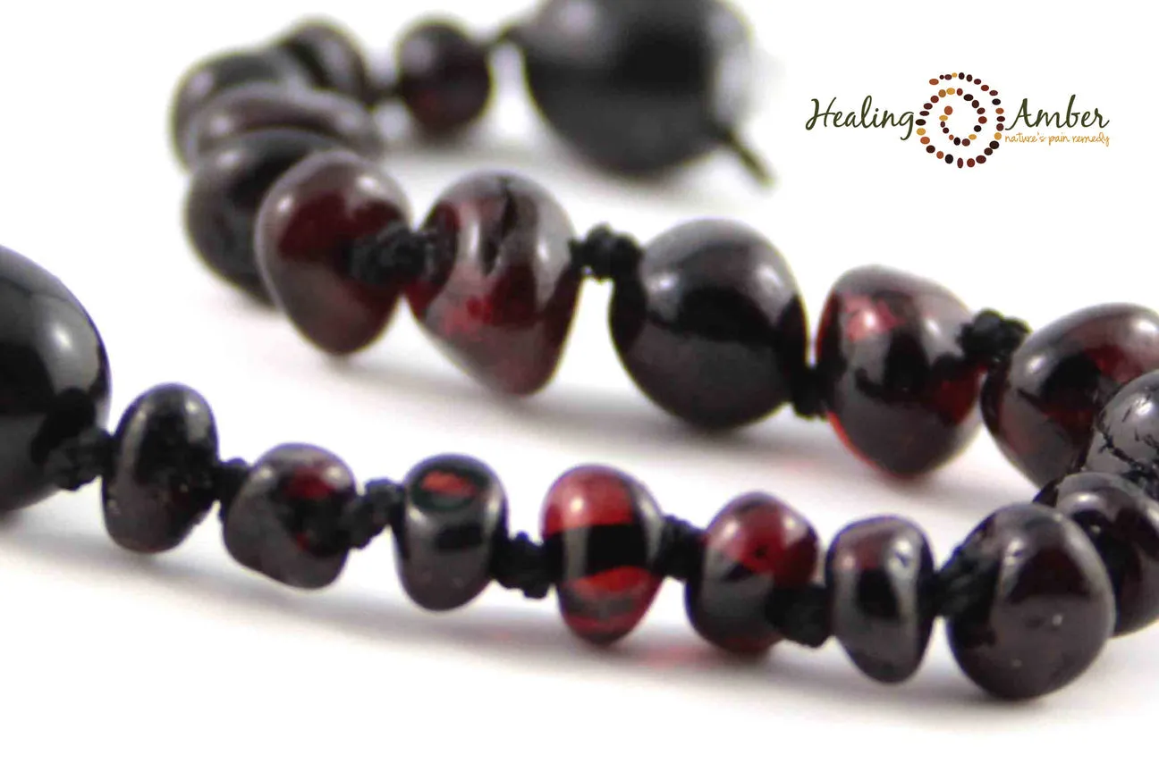 Healing Amber Polished Necklace - 13"
