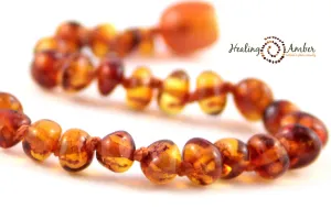 Healing Amber Polished Necklace - 13"
